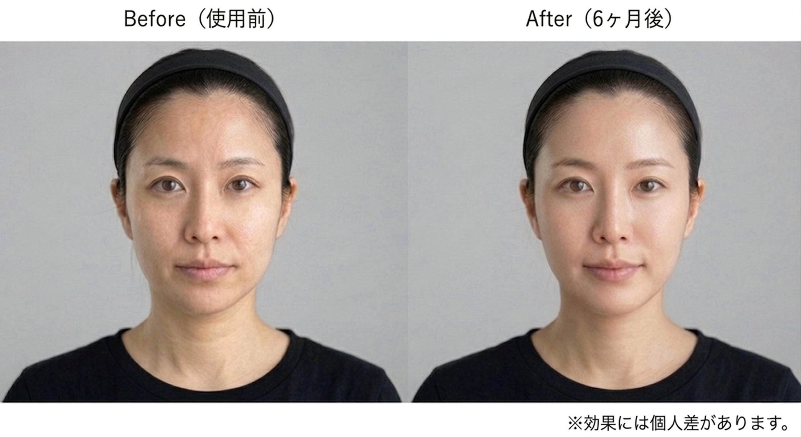 症例写真
